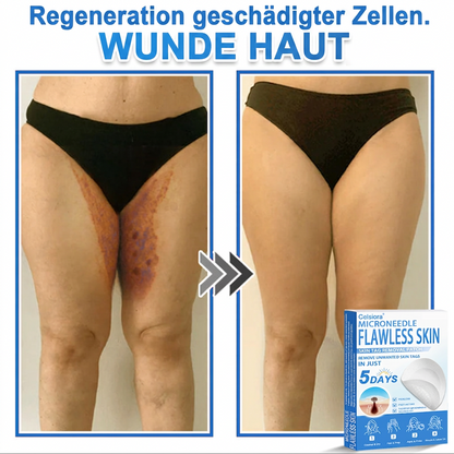 👩‍⚕️ Curalona® 2-in-1 Microneedle & Hydrocolloid Patches | Advanced Skin Care Patches for Blemishes, Skin Tags & Uneven Skin Texture | Helps Improve the Look of Fine Lines, Marks & Imperfections | Invisible Star Spot Patches for Face & Body