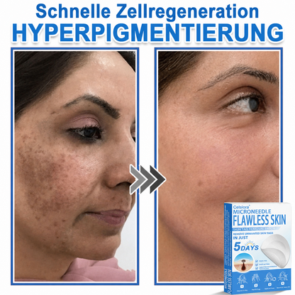 👩‍⚕️ Curalona® 2-in-1 Microneedle & Hydrocolloid Patches | Advanced Skin Care Patches for Blemishes, Skin Tags & Uneven Skin Texture | Helps Improve the Look of Fine Lines, Marks & Imperfections | Invisible Star Spot Patches for Face & Body