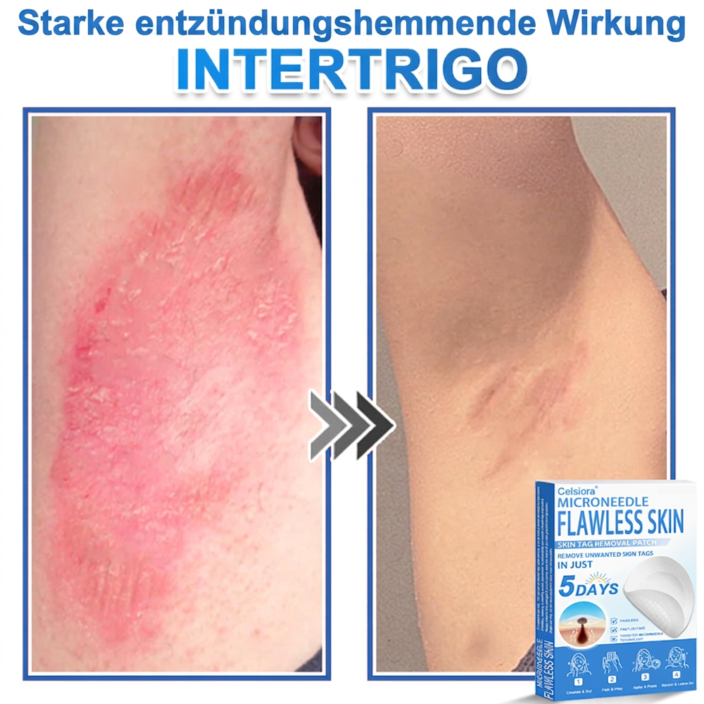 👩‍⚕️ Curalona® 2-in-1 Microneedle & Hydrocolloid Patches | Advanced Skin Care Patches for Blemishes, Skin Tags & Uneven Skin Texture | Helps Improve the Look of Fine Lines, Marks & Imperfections | Invisible Star Spot Patches for Face & Body