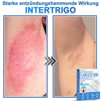 👩‍⚕️ Curalona® 2-in-1 Microneedle & Hydrocolloid Patches | Advanced Skin Care Patches for Blemishes, Skin Tags & Uneven Skin Texture | Helps Improve the Look of Fine Lines, Marks & Imperfections | Invisible Star Spot Patches for Face & Body