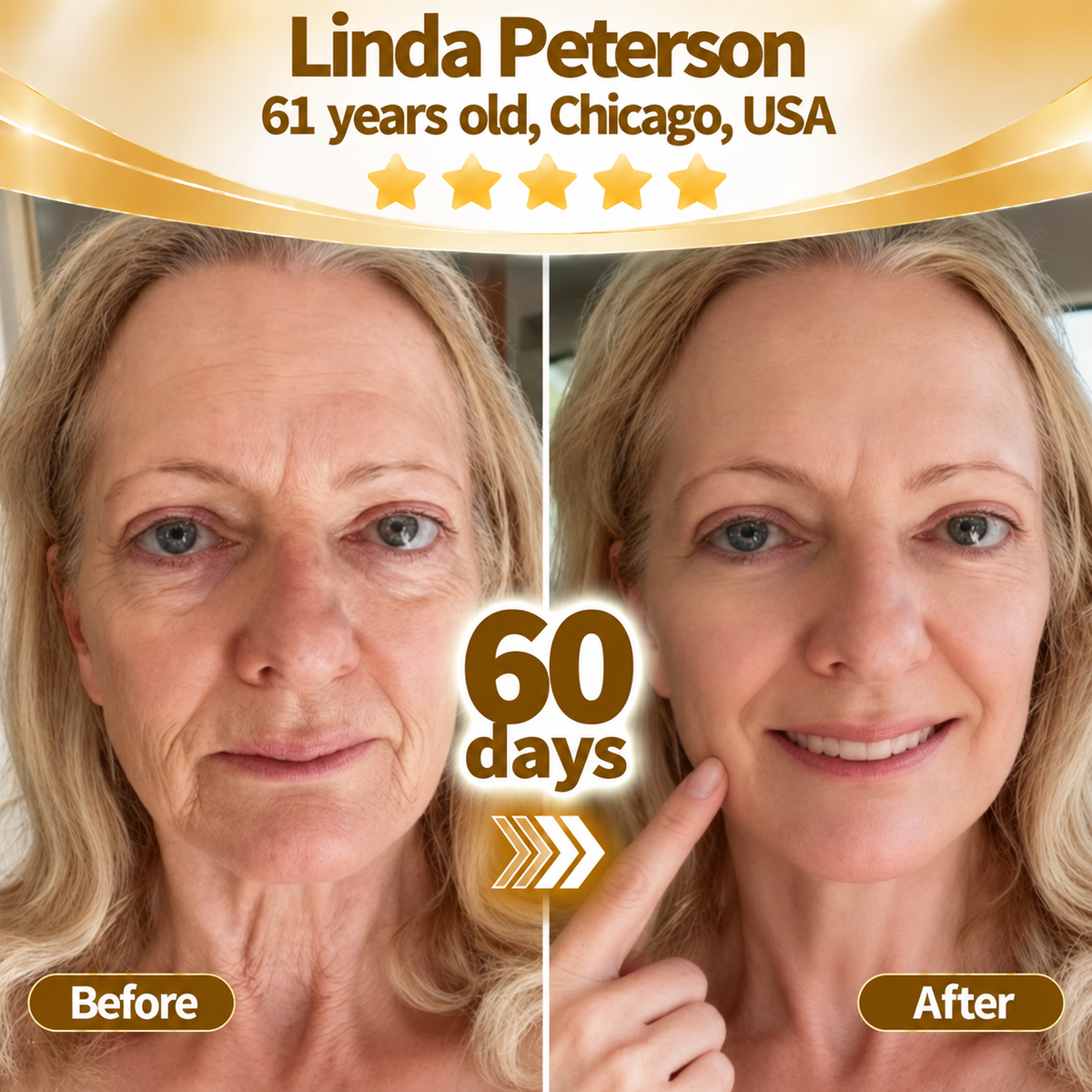 🔥 LAST DAY: 80% OFF | Snake Venom Anti-Wrinkle Serum – Smooth Fine Lines & Firm-Looking Skin